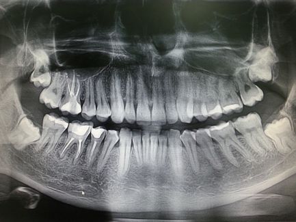 rentgenodiagnostika-v-orshe-kachestvo