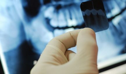 rentgenodiagnostika-v-orshe
